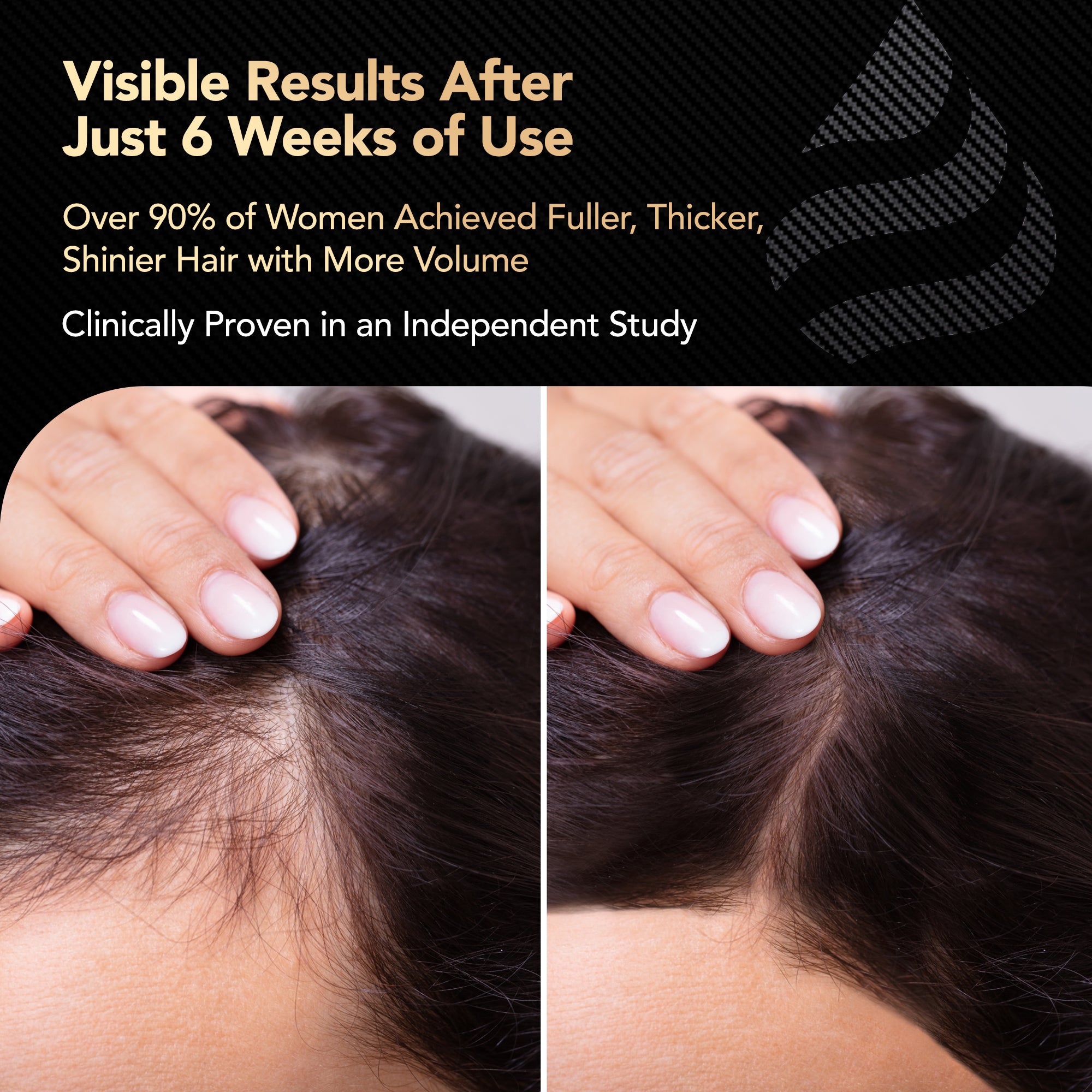 Hair Growth Vitamins - New & Improved