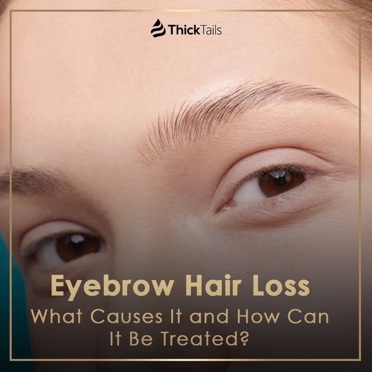 Eyebrow Hair Loss Causes and Treatment