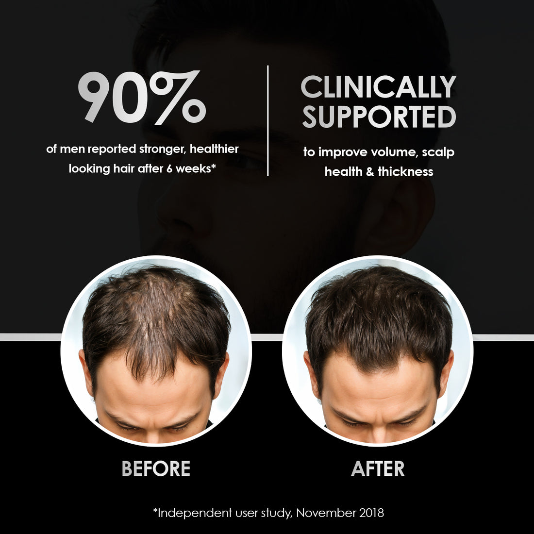 ThickTails Men’s Stimulating Hair Growth Shampoo &amp; Conditioner | Dual Pack