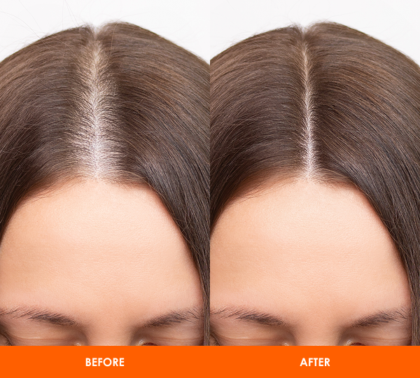 Group 37 (2).png__PID:5813ca2e-0379-4ad8-845a-fd6c164cceee