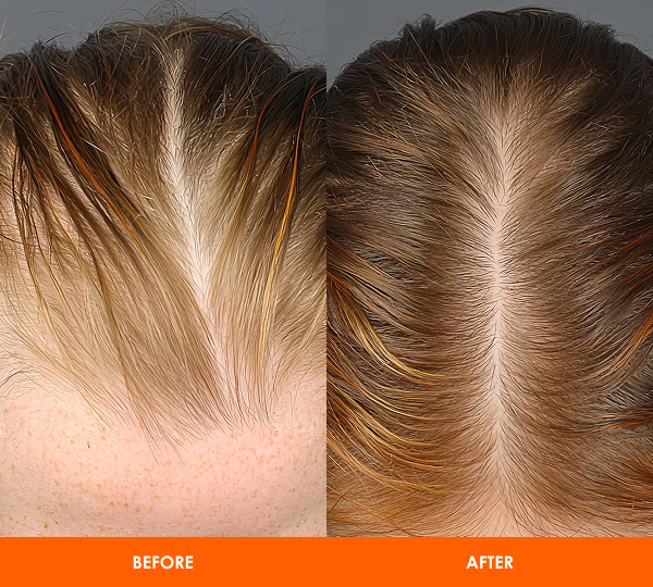 Group 38.png__PID:ca2e0379-bad8-445a-bd6c-164cceee48c8